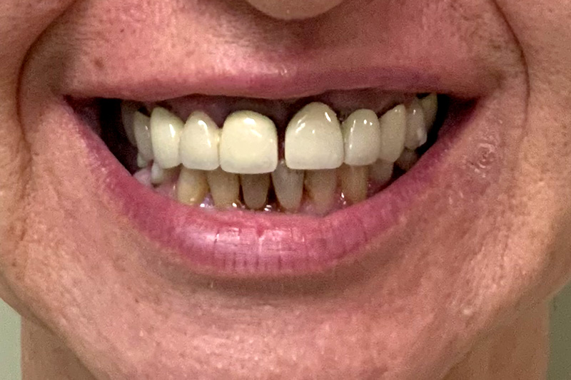 Before image