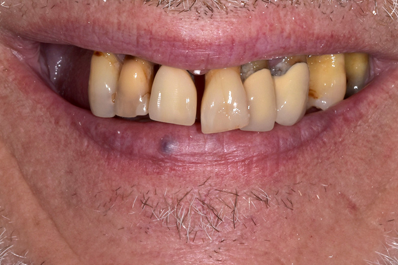 Before image