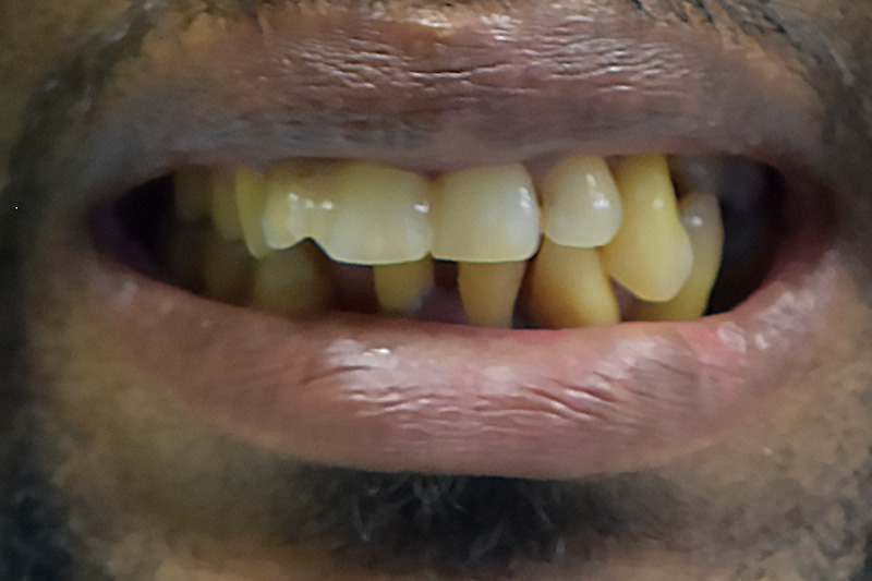 Before image