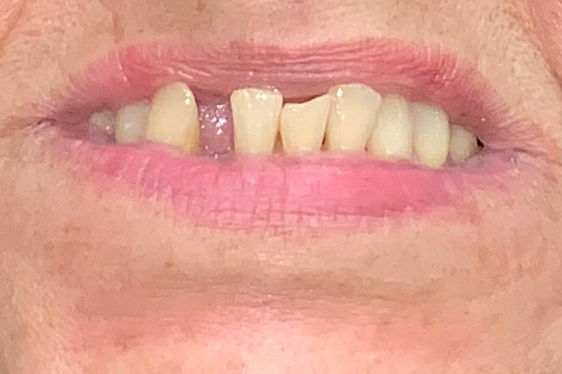 Before image