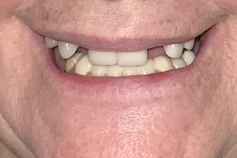 Before image