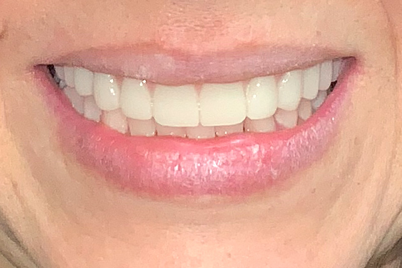 After image