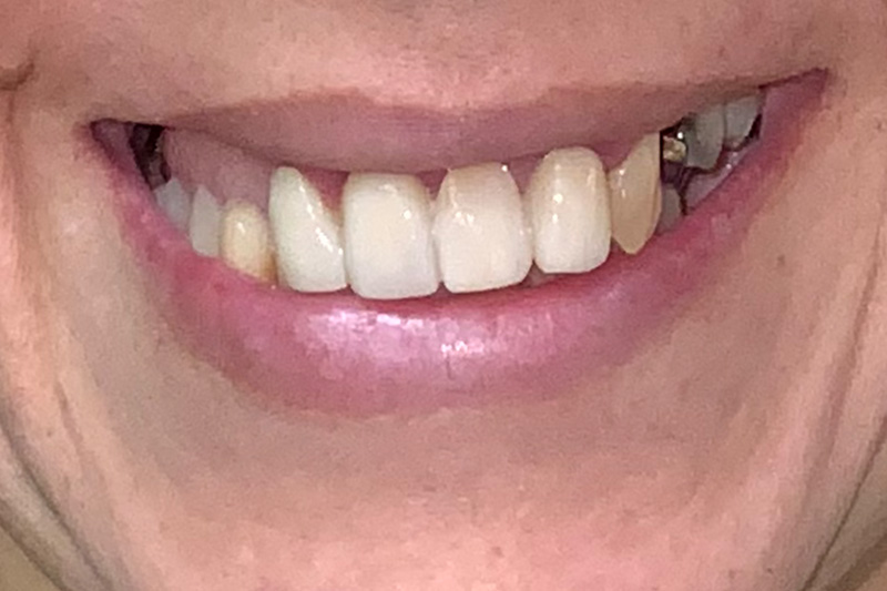 Before image