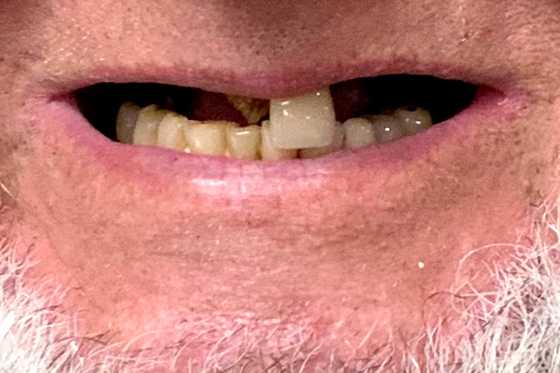 Before image