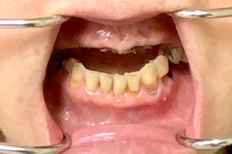 Before image