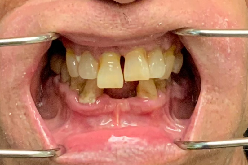 Before image
